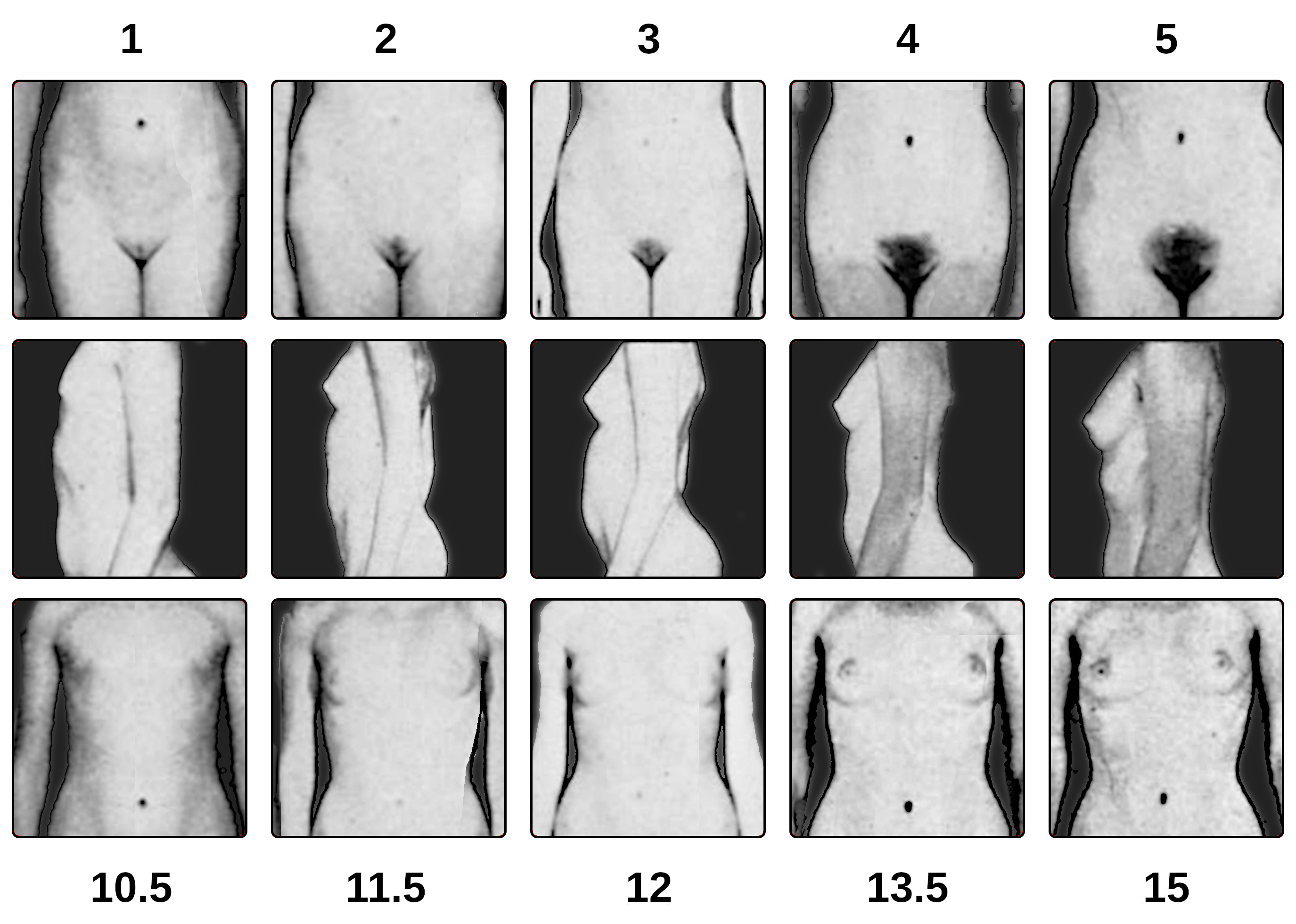 Tanner_scale_female-2